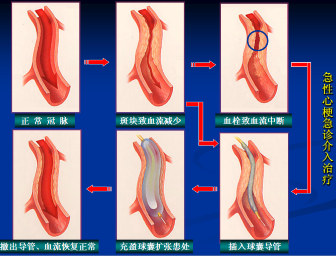14.png